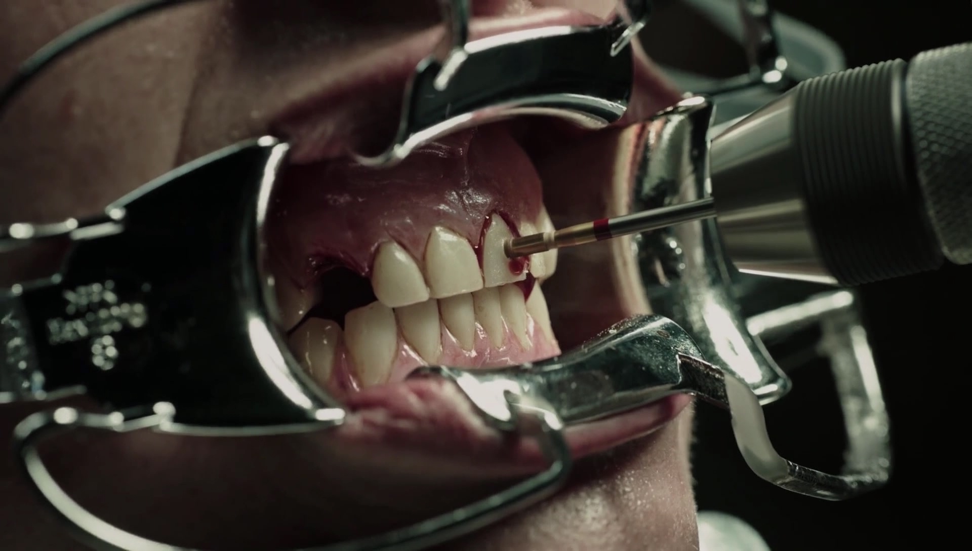 A_Cure_for_Wellness_1419.jpg A_Cure_for_Wellness_1419.jpg