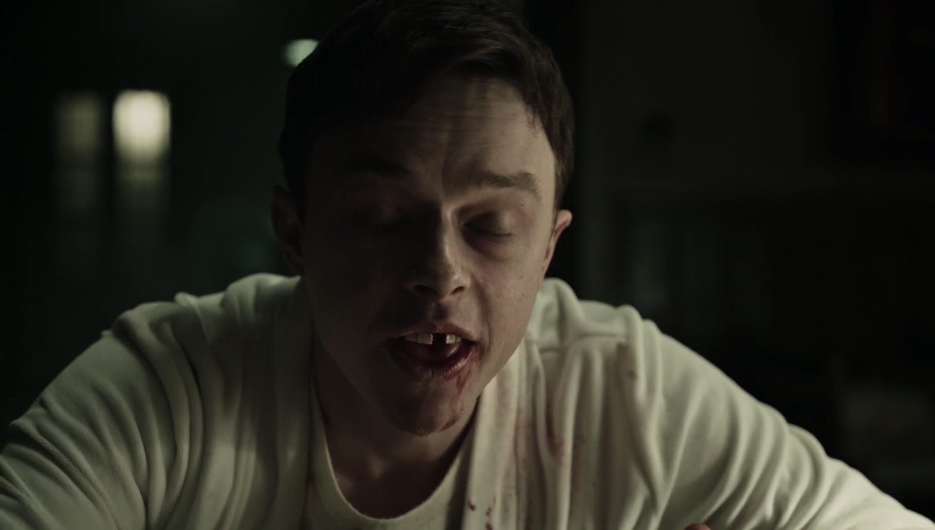 A_Cure_for_Wellness_1423.jpg A_Cure_for_Wellness_1423.jpg